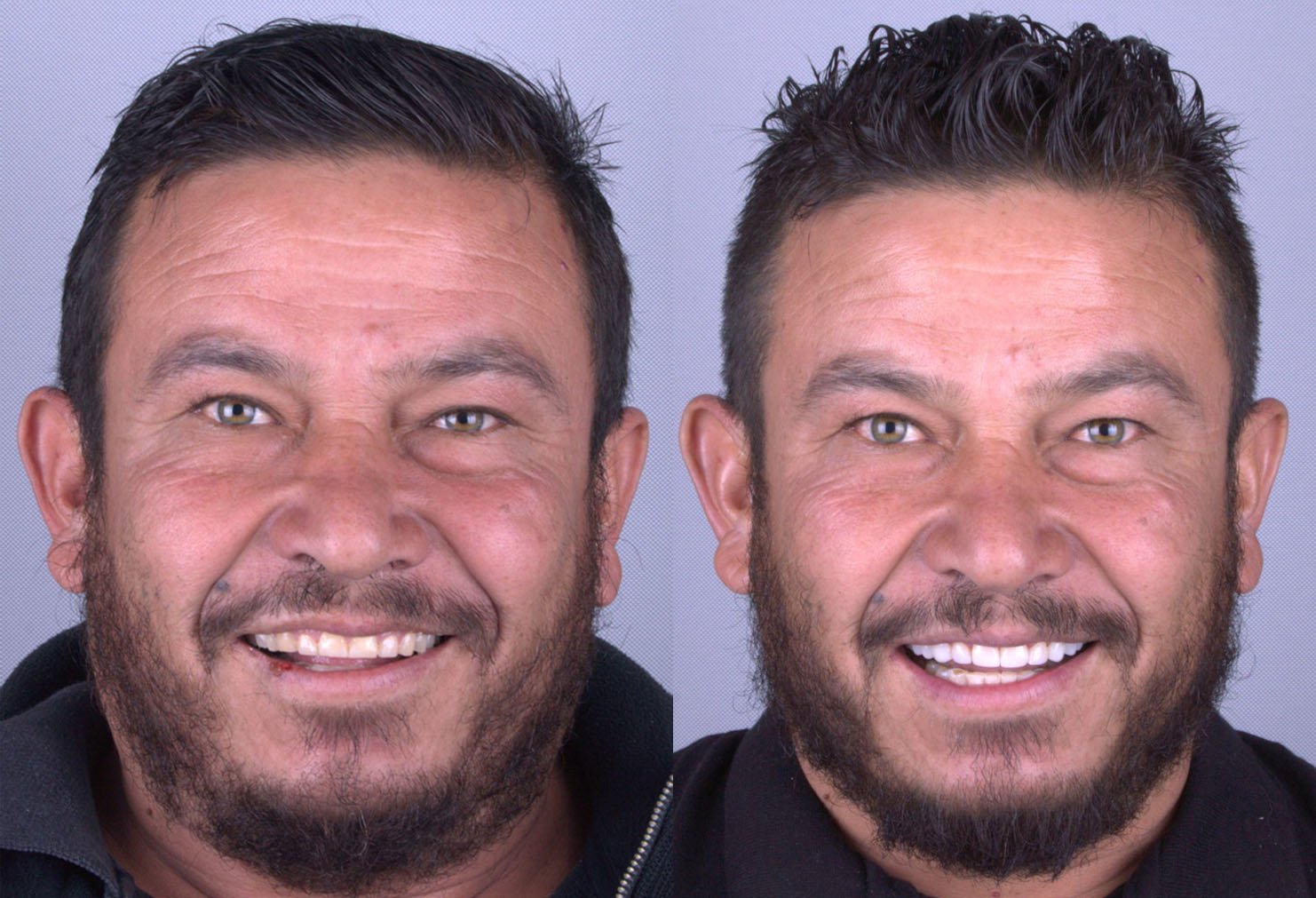 Caso 10 - Antes y Después